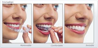 Orthodontics